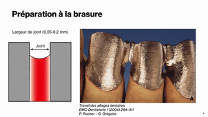Chapitre 2 : Alliages dentaires partie 1
