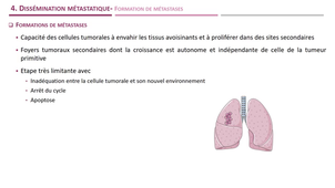 DFGSM2 - MED0302 - Progression métastatique - Dissémination métastatique