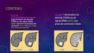 Séquence UE MED302 Sémiologie Imagerie