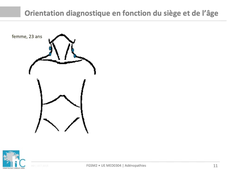 DFGSM2 / DFGSMa2 - MED0304 - Adénopathies et Splénomégalie - Démarche diagnostique devant une adénopathie