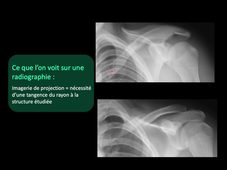 Part 2 Radiographie standard