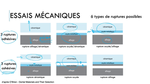 Cours  Céramique N°2 Liaison Céramo-Métallique