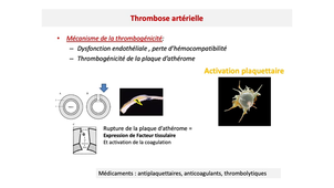 DFGSM2 / DFGSMa2 - MED0304 - Physiopathologie de la thrombose et de la coagulation intravasculaire disséminée - Physiopathologie de la thrombose artérielle