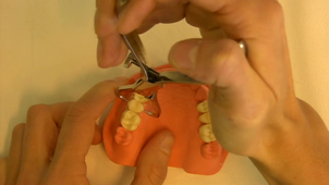 Pince de Furrer : Utilisation