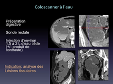 UE MED 0403 Appareil digestif : généralités