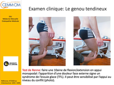 DIU de Médecine Manuelle et Ostéopathie en Médecine Générale - Examen programmé du genou