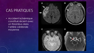 DFGSM2 - MED0308 - Sémiologie radiologique - IRM