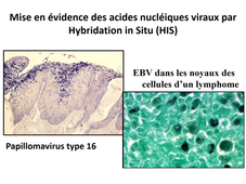 DFGSM3 - MED0602 - Pathologie inflammatoire - Inflammation virale : généralités