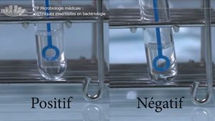 Vidéo 4 - Les tests biochimiques  1 : la catalase