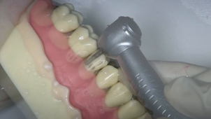 PCP 25 reduction V