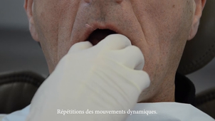 PAC 4A : EAF mandibulaire avec un PEIRA au polyether (1 temps)