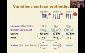 Session 1 - cours 2 - Prothèses dispo