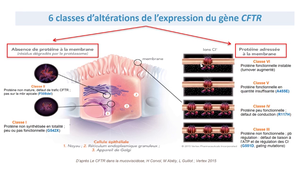 DFGSM2 - MED0302 - Mucoviscidose - Gène CFTR et protéine