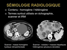 DFGSM2 - MED0308 - Sémiologie radiologique - Introduction aux techniques d'imagerie