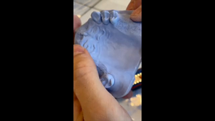 Edentation du moulage Frasacoî.