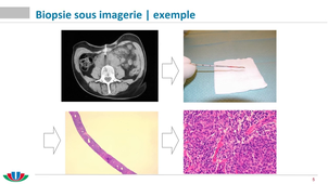 Technique d'étude des hémopathies - partie 3