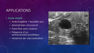 DFGSM2 - MED0308 - Sémiologie radiologique - Echographie