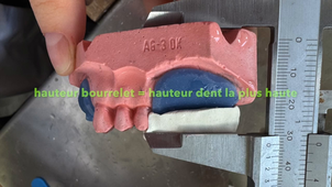 Maquette d'occlusion 2/2