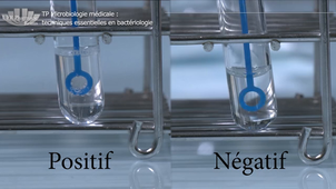 Vidéo 4 - Les tests biochimiques 1 - la catalase