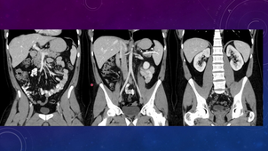 Radioanatomie UEMED0302