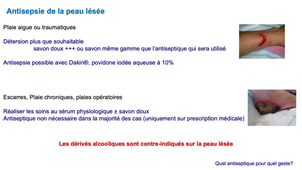 DFGSM3 / DFASM2 - MED0501 / Santé publique - Prévention des infections associées aux soins : définitions et règles d'utilisation des antiseptiques - Choix de l'antisepsie selon l'acte m