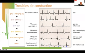 DE IPA URGENCES - ECG - UE12_BF_7