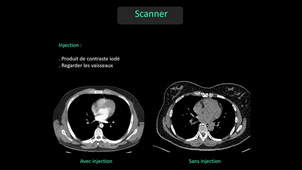 DFGSM2 - MED0308 - Sémiologie radiologique - Scanner