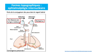 DFGSM2 - MED0308 - Sémiologie neurologique - Diplopie / Paralysie faciale / Troubles de la déglutition / Troubles de la phonation / Sémiologie des nerfs crâniens