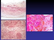 DFGSM3 - Substrats anatomiques des maladies cardiovasculaires (Partie 2)