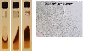 champignons filamenteux et dermatophytes