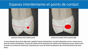 UE 24 - EC5 - Anatomie spécifique de la bouche 4