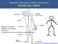 Sémiologie Cardiovasculaire - partie 2 - Examen physique - J Costa