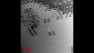 microscopie électronique