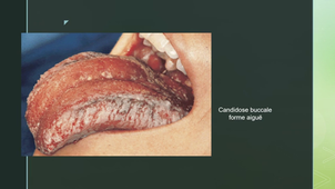 UE44 EC2 Odontologie : Impacts Santé oral sur santé générale