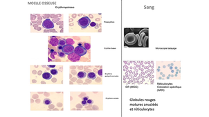 DFGSM2 / DFGSMa2 - MED0304 - Hématopoïèse - Erythropoïèse