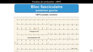 DE IPA URGENCES - DYSFONCTION STIM DEF- UE13_C_17
