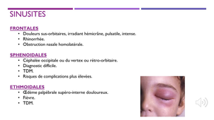 DE IPA URGENCES - Pathologies ORL : rhinologie 'nez' - UE13_C_34_2