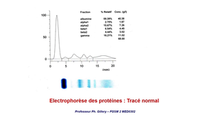 MED0302 - Sémiologie des protéines plasmatiques (Séquence 1)