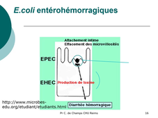 Infections digestives bactériennes E. coli