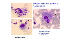 DFGSM2 / DFGSMa2 - MED0304 - Hématopoïèse - Mégacaryocytopoïèse