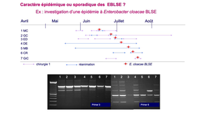 DFGSM3 - MED0501 - BMR et BHRe - Entérobactéries productrices de bêta-lactamase à spectre étendu