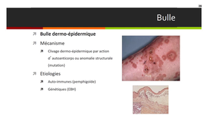 Sémiologie dermatologique (Séquence 3)