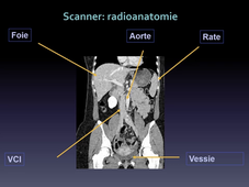UE MED 0403 Appareil digestif : radio anatomie