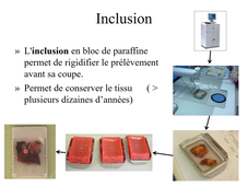 UE MED0302 - Notions fondamentale de pathologie - Séq 2