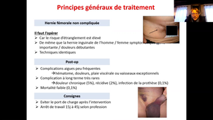 Anatomie : paroi de l'abdomen