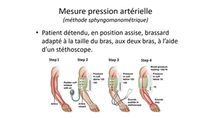 DFGSM2 - MED0308 - Sémiologie cardiologique - Examen clinique : inspection, poids, fréquence cardiaque, pression artérielle