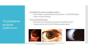 DE IPA URGENCES - Démangeaisons, oeil rouge non douloureux, Corps étranger, BrÃ»lure oculaire, Trouble  visuel, oeil douloureux, Cécité et Traumatisme oculaire avec faible vélocité et mauvaise