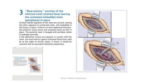 session 1 cours 15 infection