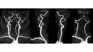 DFGSM3 - Imagerie : Crâne / Encéphale - Moelle - Hypophyse - Oreille (Introduction)