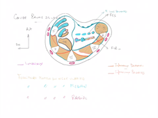 Plexus Brachial